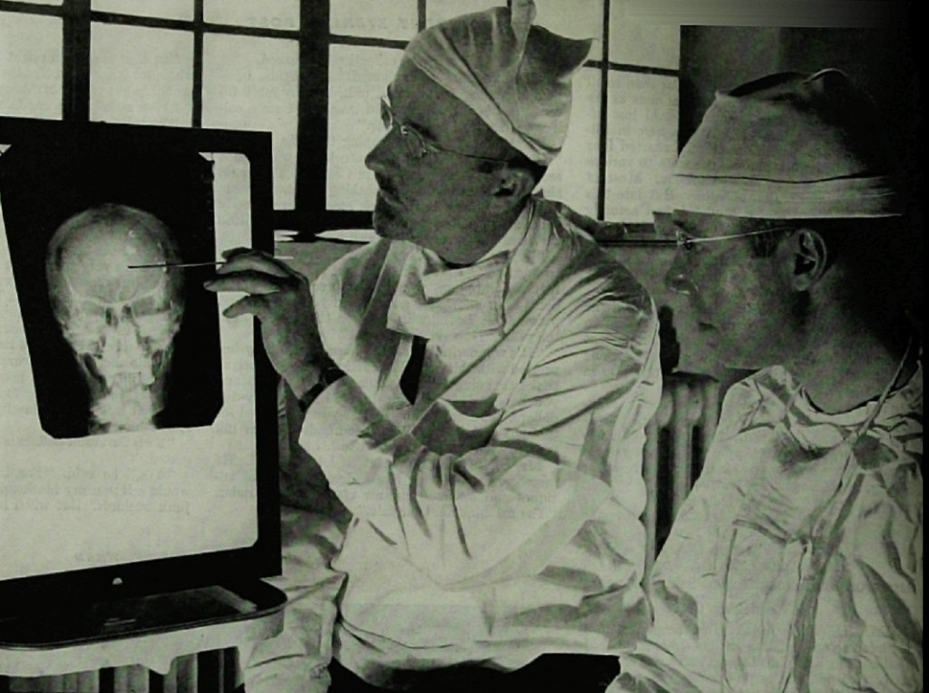 A lot has changed since psychosurgery and electroconvulsive therapy were the only treatment options (Wikimedia Commons)