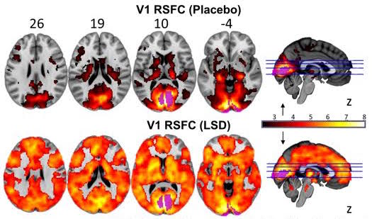 Visual cortex connectivity under LSD and placebo (Beckley Foundation)